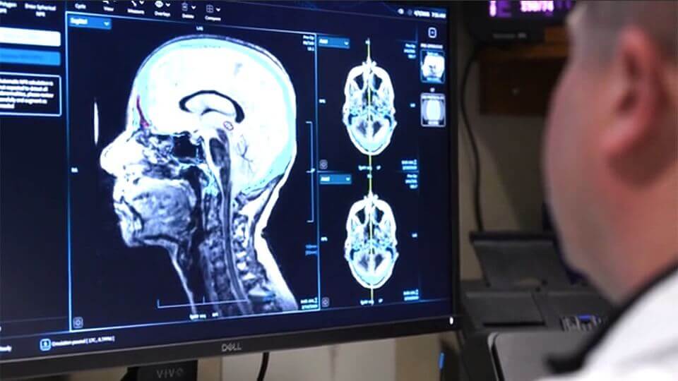 Brain & spine care video thumnail image