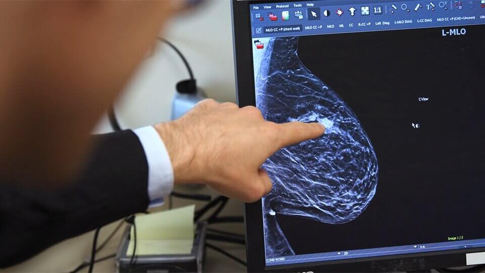 Cancer care video thumbnail
