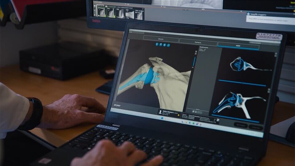 Orthopedic care video thumbnail